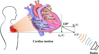 Contactless multiscale measurement of cardiac motion using biomedical radar sensor